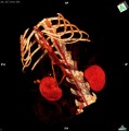 CT - angiografie (kočka)